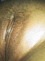 Photo 9, Swollen Korean Sleeping