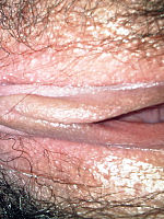 Photo 10, Ambers Hairy And