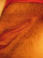 Photo 2, Closeup Teen Cunt