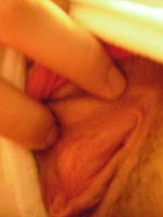 Photo 4, Closeup Teen Cunt