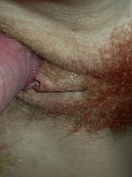 Photo 10, Fire Crotch On The